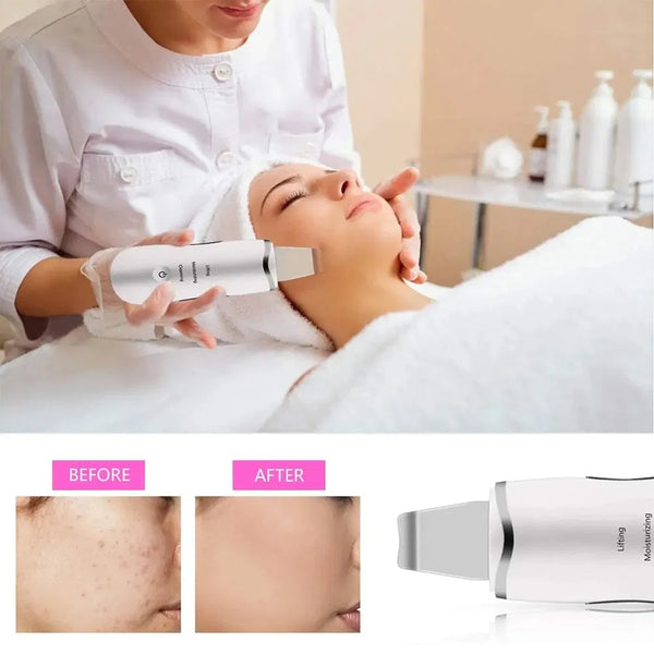 Ultrasonic Facial Spatula